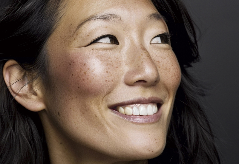 Hyperpigmentation: everything you need to know